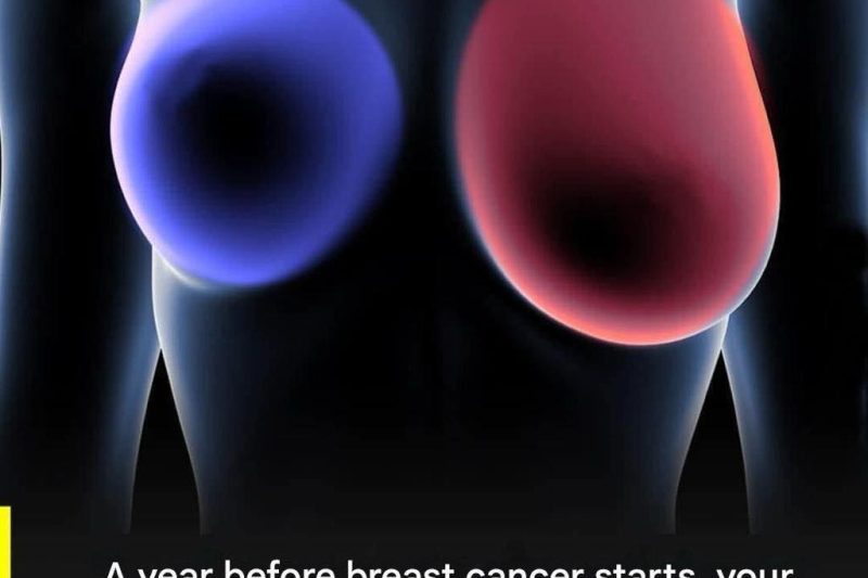 Breast Cancer Awareness: Four Early Warning Signs Every Woman Should Recognize